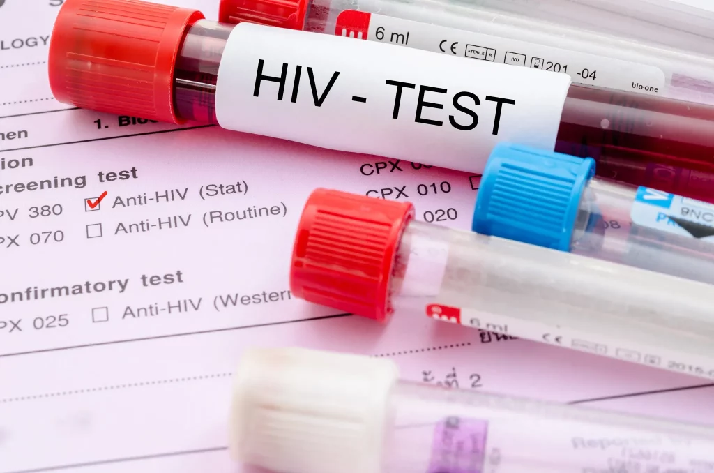 Các lựa chọn xét nghiệm HIV miễn phí hoặc được hỗ trợ