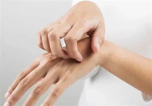 HIV có lây qua tiếp xúc da không