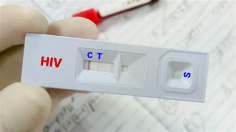 Những Lưu Ý Quan Trọng Khi Đi Xét Nghiệm HIV Miễn Phí