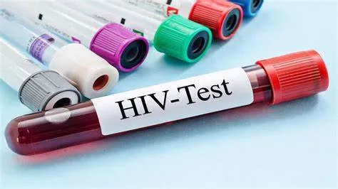 Test nhanh HIV là gì? Cơ chế hoạt động