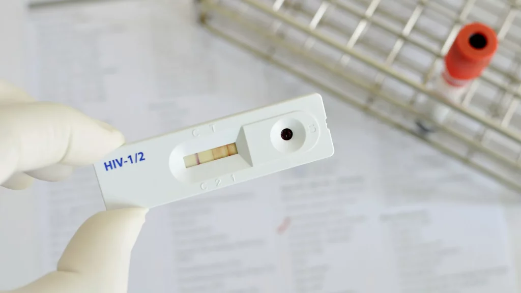 test nhanh HIV có chính xác không