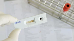 test nhanh HIV có chính xác không