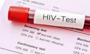 xét nghiệm HIV ở đâu uy tín